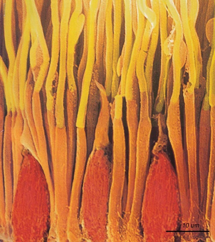 Micrografía electrónica de barrido de bastones y conos en la retina de un primate (colores falsos). Helga Kolb, CC BY-SA Micrografía electrónica de barrido de bastones y conos en la retina de un primate (colores falsos). Helga Kolb, CC BY-SA